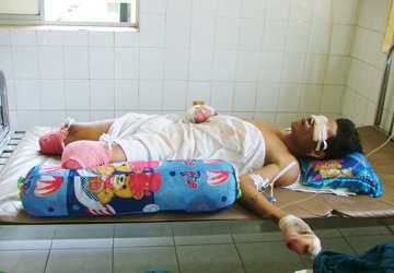 Nổ lớn, bố chết, con nhập viện