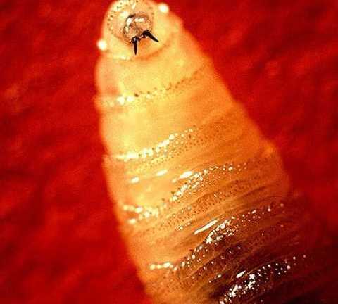 Rợn người cô gái bị ấu trùng ruồi ăn thịt đục não