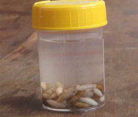 50 con dòi lúc nhúc ăn đứt tai bé gái