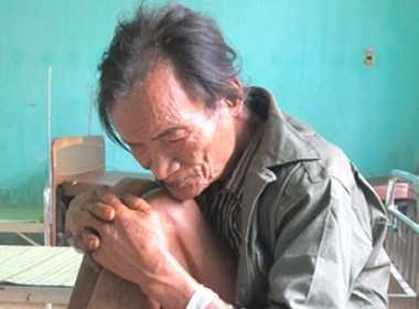 'Người rừng' Quảng Ngãi sẽ được điều trị tâm lý