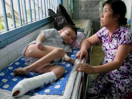 Tin hot 29/8: Xác định bệnh lạ khiến chân tay thối rữa