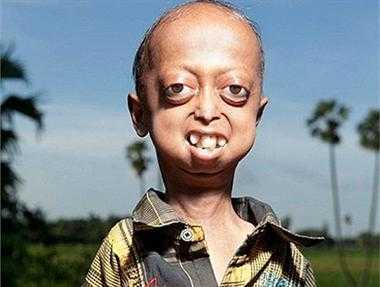 Tâm sự đau lòng của cậu bé 14 trong thân thể ông lão