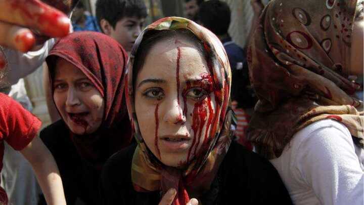 Kịch bản nào cho vụ tấn công quân sự Syria?