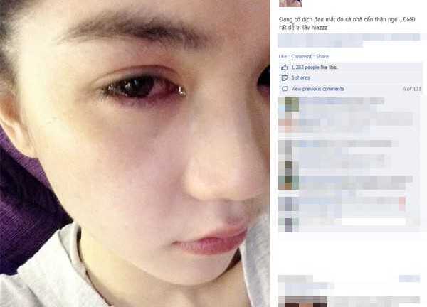 Tin hot 25/9: Ngọc Trinh nhiễm đau mắt đỏ