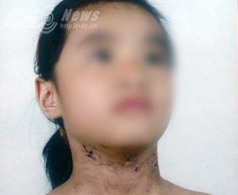 Khởi tố bố đẻ bạo hành con gái dã man ở Hải Dương