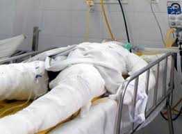 Một phụ nữ bị tạt xăng thiêu sống khi đang ngủ