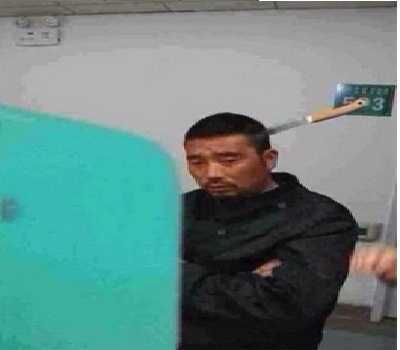 Cư dân mạng 'sốt' trước quý ông bị dao cắm phập đầu