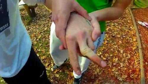 Lòi xương sau màn biểu diễn thất bại