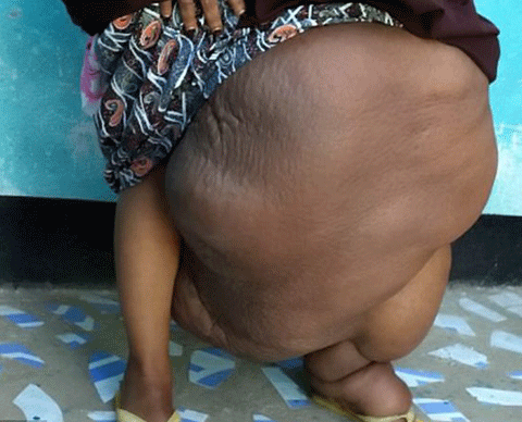 Không ai tin đây là chân một phụ nữ