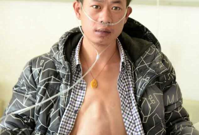Kỳ lạ người đàn ông có tim trong bụng