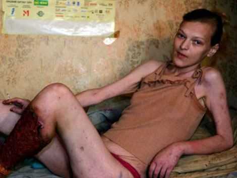 Nữ sinh tự tiêm ma tuý 