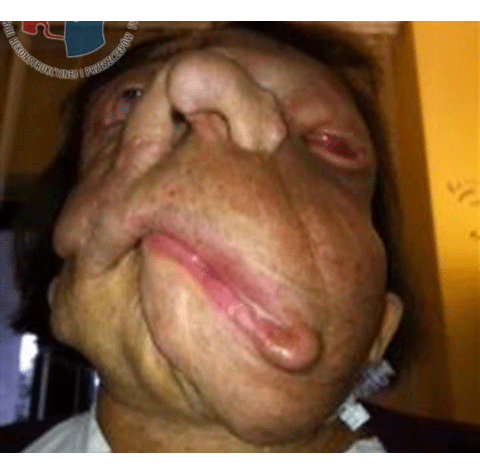 Xót lòng cô gái mang gương mặt quỷ