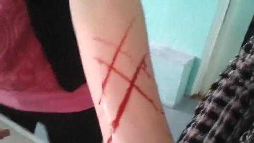 Nữ sinh bị cô giáo 'rạch tay' giữa lớp