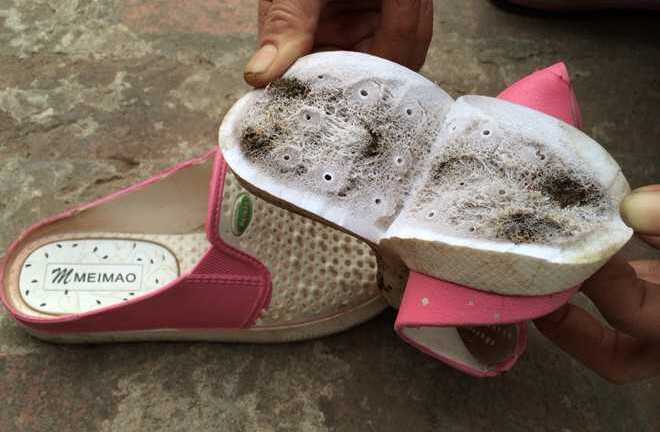 Lý giải hiện tượng ngứa rát, tê chân khi đi dép TQ