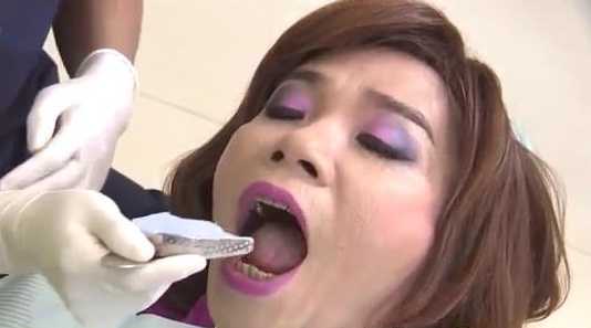 Rò rỉ clip 'Bắc Đẩu' Công Lý đi trồng răng