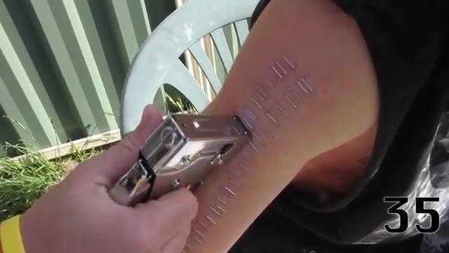 Nghịch dại để bạn bấm 100 cái ghim lên người đau đớn