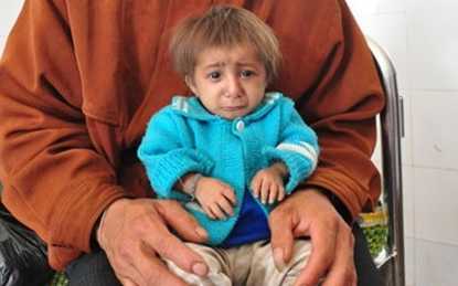 Kỳ lạ bé 5 tuổi cao 50cm, nặng 3kg ở Quảng Ngãi