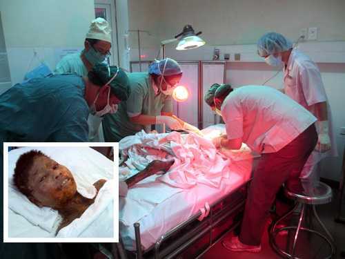 Kon Tum: Đau lòng bé gái da thối rữa bị bố bỏ rìa làng