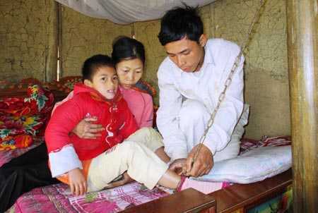 Cô bé 'ma cà rồng' và sở thích ăn thịt sống