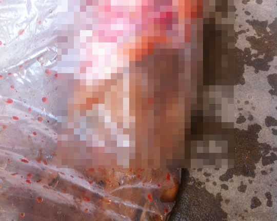 Sự thật bàn chân người dính máu trên xe khách