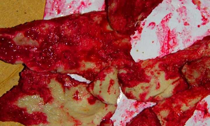 Thịt lợn chín chuyển màu đỏ máu: Đã truy ra 'thủ phạm'