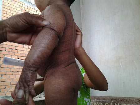 Chuyện lạ về cậu bé 'hóa rắn' ở ‘vương quốc hành’