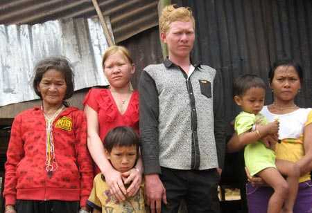 Người phụ nữ ăn thịt, uống mật và máu rái cá sinh con giống... Tây