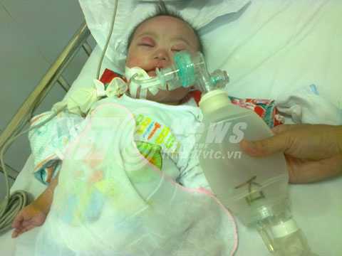 Nhiễm sởi trong bệnh viện, tại sao nhiều trẻ tử vong?