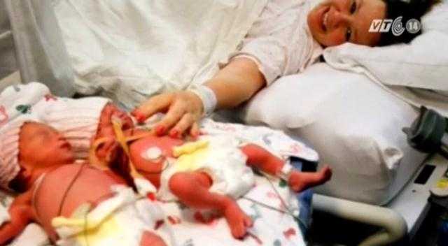 Clip: Cặp song sinh nắm chặt tay nhau lúc chào đời