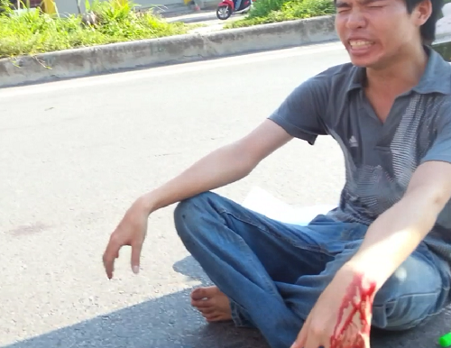 Nam thanh niên tự cắt tay, ngồi 'thiền' giữa lòng đường