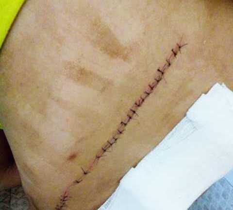 Khánh Hòa: Kẻ biến thái liên tục tấn công, rạch người nữ giới