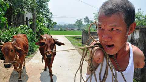 Người không tay thần kỳ