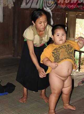 Cậu bé khổng lồ ở Hòa Bình, giờ ra sao?