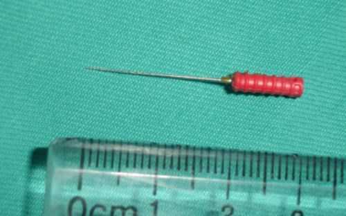 Há miệng lâu mỏi mồm, bé nuốt phải kim nha khoa