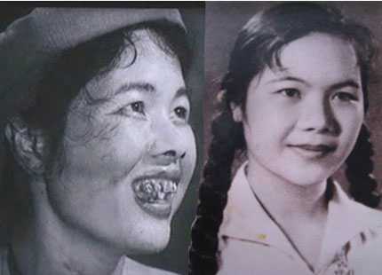 'Huyền thoại Thị Nở' tiết lộ mối tình đầu dang dở