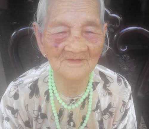 Cụ bà 104 tuổi tay không bắt cướp