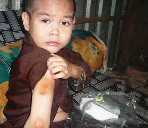 4 trẻ bị bạo hành nhiều năm liền, chính quyền thờ ơ