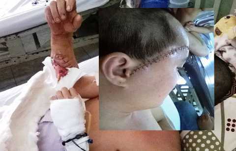 Đập vỡ kính kẻ nẹt pô, 4 người bị chém xối xả