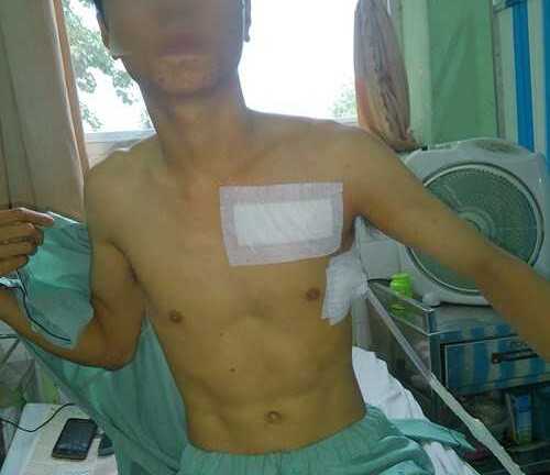 Đâm thấu ngực hàng xóm vì hát karaoke gây ồn ào