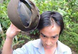 Dùng tuýp sắt đập vỡ đầu bác ruột