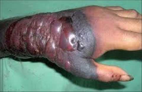 Bệnh dịch Ebola đã lan sang châu Á?
