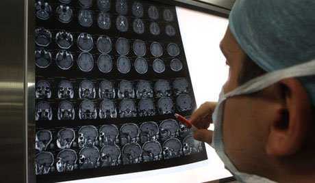 Nhà khoa học Italia tuyên bố có thể cấy ghép đầu người