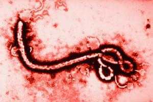 Xà phòng tiêu diệt được virus Ebola