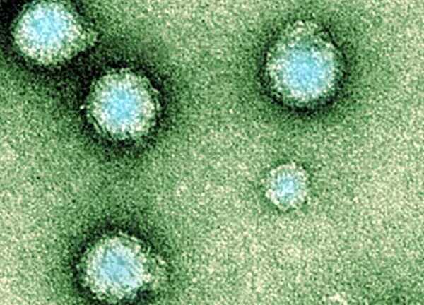 Thêm 1 loại virus lạ nguy hiểm chết người