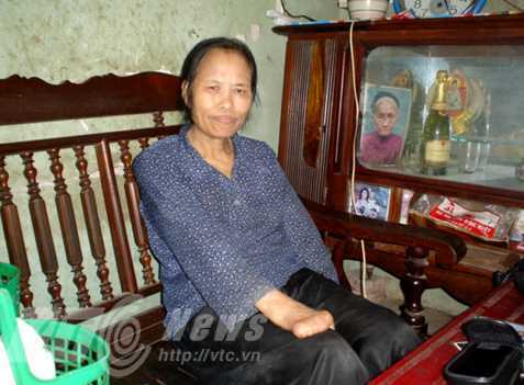 Khó tin người đàn bà 10 lần nung đỏ dao chặt tay mình