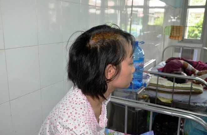 Bắt giam 'cha dượng' chém nứt sọ bé 15 tuổi