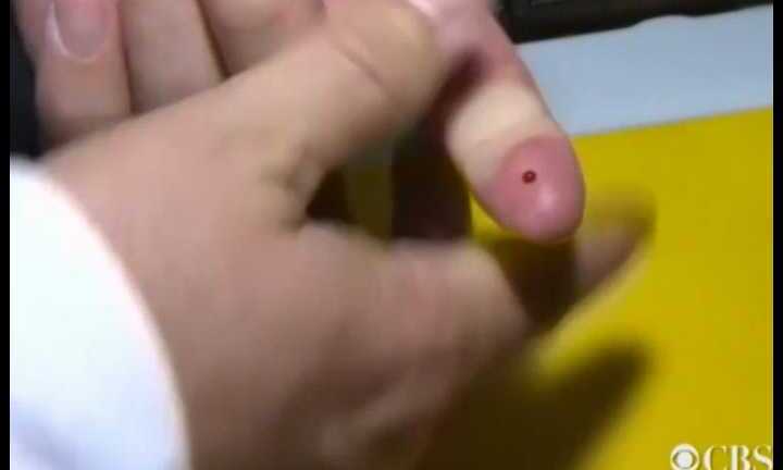 Bác sĩ Mỹ nhiễm Ebola một cách bí ẩn