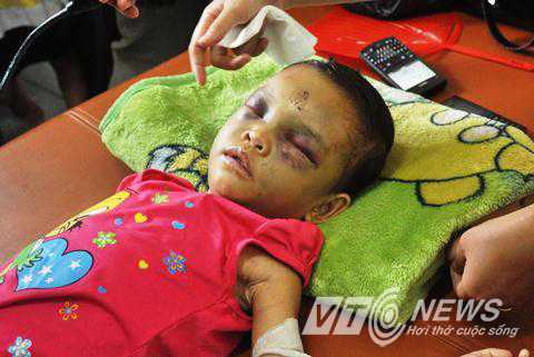 Xem xét khởi tố 2 kẻ đánh con dã man như thời trung cổ