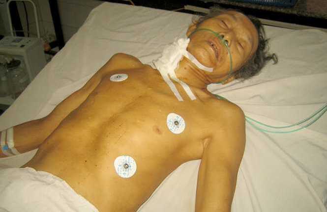 Cha bị con có dấu hiệu tâm thần cứa cổ khi đang ngủ