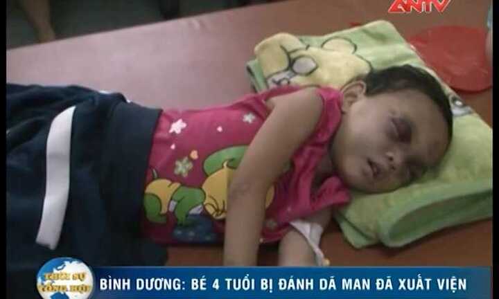 Bé Kim Ngân bị bạo hành giờ ra sao?